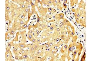 IHC image of ABIN7167891 diluted at 1:300 and staining in paraffin-embedded human liver tissue performed on a Leica BondTM system. (RECK anticorps  (AA 23-212))