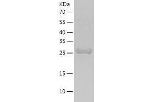 Western Blotting (WB) image for Methylmalonic Aciduria (Cobalamin Deficiency) CblC Type, with Homocystinuria (MMACHC) (AA 1-282) protein (His-IF2DI Tag) (ABIN7123941)