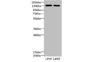 Tpp2 anticorps  (AA 1-300)