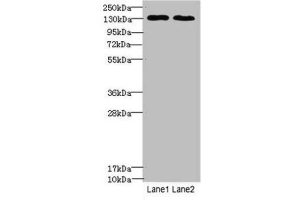 Tpp2 Antikörper  (AA 1-300)