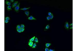 Immunofluorescent analysis of PC-3 cells using ABIN7173103 at dilution of 1:100 and Alexa Fluor 488-congugated AffiniPure Goat Anti-Rabbit IgG(H+L) (TMEM177 anticorps  (AA 219-311))