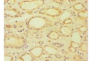 Immunohistochemistry of paraffin-embedded human kidney tissue using ABIN7158678 at dilution of 1:100 (BRCC3 anticorps  (AA 1-316))