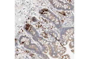 Immunohistochemical staining of human colon with KBTBD5 polyclonal antibody  shows strong positivity in Paneth cells. (KBTBD5 anticorps)