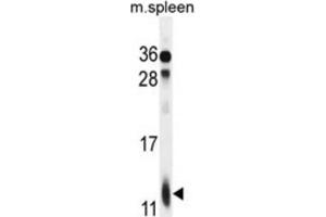 Western Blotting (WB) image for anti-Ribosomal Protein L39 (RPL39) antibody (ABIN2996042) (RPL39 anticorps)