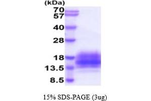 SDS-PAGE (SDS) image for Tetraspanin 7 (TSPAN7) (AA 113-213) protein (His tag) (ABIN5854851)