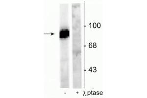 Western blot of rat hippocampal lysate stimulated with forskolin showing specific immunolabeling of the ~95 kDa dynamin phosphorylated at Ser778 in the first lane (-). (Dynamin 1 anticorps  (pSer778))