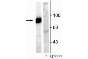 Western blot of rat hippocampal lysate stimulated with forskolin showing specific immunolabeling of the ~95 kDa dynamin phosphorylated at Ser778 in the first lane (-).