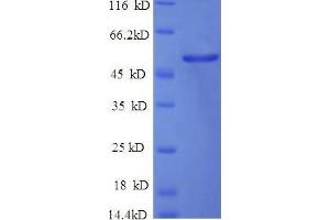Enolase 1, (Alpha) (ENO1) (AA 2-433), (partial) protein (His tag)