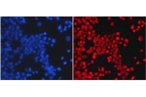 Immunofluorescence analysis of 293T cells using TriMethyl-Histone H4-K20 Polyclonal Antibody (Histone H4 anticorps  (3meLys20))