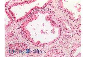ABIN334503 (5µg/ml) staining of paraffin embedded Human Prostate. (TARDBP anticorps  (Internal Region))
