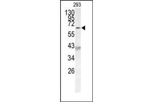 Image no. 1 for anti-Protein AF-9 (MLLT3) (C-Term) antibody (ABIN358673) (AF9 anticorps  (C-Term))