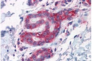 Human Breast: Formalin-Fixed, Paraffin-Embedded (FFPE) (G3BP1 anticorps  (AA 214-303))