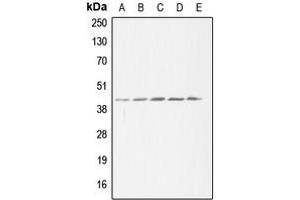 Western blot analysis of ACAT1 expression in HeLa (A), HEK293T (B), SP2/0 (C), H9C2 (D), THP1 (E) whole cell lysates.