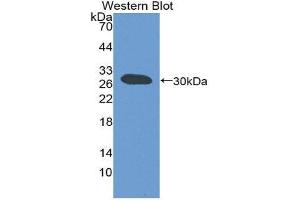 Western Blotting (WB) image for anti-ATP-Binding Cassette, Sub-Family B (MDR/TAP), Member 11 (ABCB11) (AA 420-656) antibody (ABIN1980368) (ABCB11 anticorps  (AA 420-656))