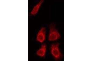 ABIN6275767 staining HeLa by IF/ICC. (HSPBAP1 anticorps  (Internal Region))