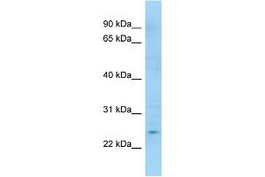 WB Suggested Anti-APOBEC3H Antibody Titration: 1. (APOBEC3H anticorps  (C-Term))