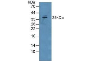 Detection of GDF15 in Human Serum using Polyclonal Antibody to Growth Differentiation Factor 15 (GDF15)