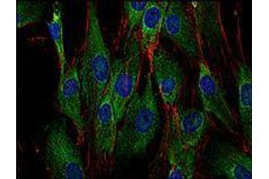 Immunofluorescence (IF) image for anti-Son of Sevenless Homolog 1 (SOS1) antibody (ABIN238504) (SOS1 anticorps)