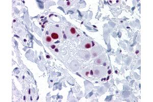 Anti-SNRPA antibody IHC of human small intestine, submucosal plexus. (SNRPA1 anticorps  (AA 1-283))