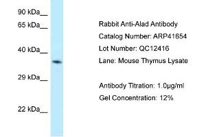 Host: Rabbit Target Name: ALAD Sample Tissue: Mouse Thymus Antibody Dilution: 1ug/ml (ALAD anticorps  (N-Term))