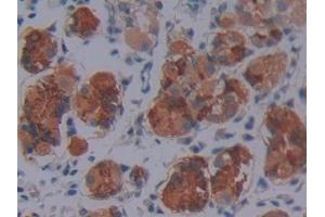 DAB staining on IHC-P; Samples: Human Stomach Tissue (SCO2 anticorps  (AA 42-266))