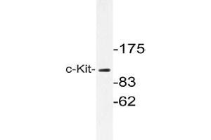 Western blot with extracts from A549 cells using c-Kit antibody . (KIT anticorps)