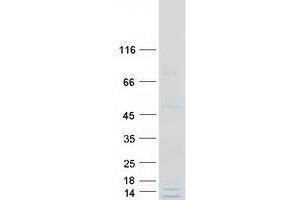 Validation with Western Blot