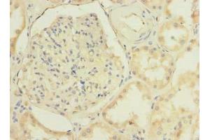 Immunohistochemistry of paraffin-embedded human kidney tissue using ABIN7173386 at dilution of 1:100