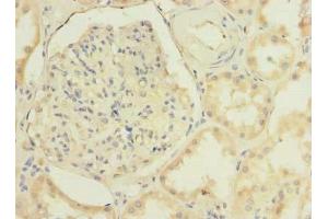 Immunohistochemistry of paraffin-embedded human kidney tissue using ABIN7173386 at dilution of 1:100 (TMEM38B anticorps  (AA 249-291))