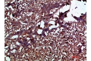 Immunohistochemical analysis of paraffin-embedded human-pancreas, antibody was diluted at 1:200 (IL17C anticorps  (AA 81-130))