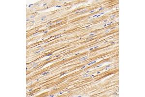 Immunohistochemistry analysis of paraffin embedded rat heart using PDK3 (ABIN7075334) at dilution of 1: 2000 (PDK3 anticorps)