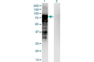 Western Blot analysis of PKP3 expression in transfected 293T cell line by PKP3 monoclonal antibody (M04), clone 6E5. (Plakophilin 3 anticorps  (AA 225-324))