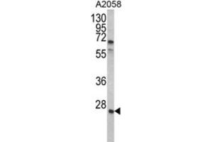 Western Blotting (WB) image for anti-Growth Factor Receptor-Bound Protein 2 (GRB2) antibody (ABIN3002593) (GRB2 anticorps)