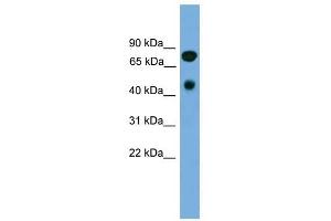 RIPK4 antibody used at 1 ug/ml to detect target protein. (RIPK4 anticorps  (N-Term))