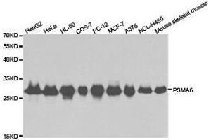 Western Blotting (WB) image for anti-Proteasome Subunit alpha 6 (PSMA6) antibody (ABIN1874369) (PSMA6 anticorps)
