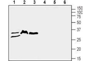 Western blot analysis of mouse lung (lanes 1 and 4), rat brain (lanes 2 and 5) and mouse brain (lanes 3 and 6) lysates: - 1-3. (SLC39A3 anticorps  (1st Extracellular Loop))