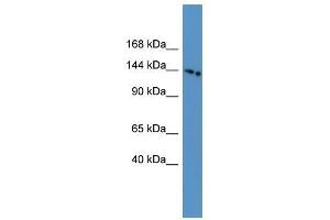Western Blot showing SLC4A5 antibody used at a concentration of 1-2 ug/ml to detect its target protein. (NBC4 anticorps  (N-Term))