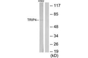 Western Blotting (WB) image for anti-Thyroid Hormone Receptor Interactor 4 (TRIP4) (AA 81-130) antibody (ABIN2889614) (TRIP4 anticorps  (AA 81-130))