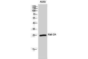 Western Blotting (WB) image for anti-RAB2A, Member RAS Oncogene Family (RAB2A) (Internal Region) antibody (ABIN3177066) (RAB2A anticorps  (Internal Region))