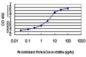 Detection limit for recombinant GST tagged DOT1L is approximately 0. (DOT1L anticorps  (AA 3-108))