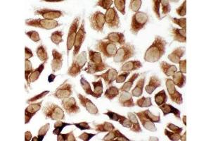 ICC testing of TRAM antibody and HeLa cells