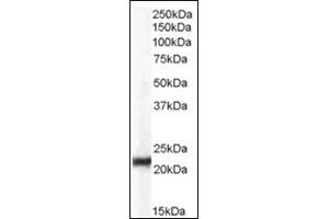 Image no. 2 for anti-Chromobox Homolog 5 (CBX5) (Internal Region) antibody (ABIN374617) (CBX5 anticorps  (Internal Region))