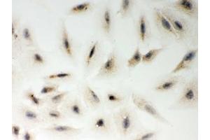 ICC testing of FFPE human A549 cells with LYRIC antibody. (MTDH anticorps  (AA 101-270))