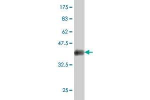 Western Blot detection against Immunogen (38.