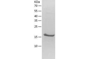 Western Blotting (WB) image for NFKB Inhibitor Interacting Ras-Like 1 (NKIRAS1) (AA 1-192) protein (His-IF2DI Tag) (ABIN7124164)
