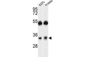 Western Blotting (WB) image for anti-ORAI Calcium Release-Activated Calcium Modulator 1 (ORAI1) antibody (ABIN3004147) (ORAI1 anticorps)