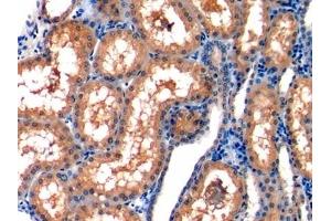 anti-Chemokine (C-C Motif) Ligand 2 (CCL2) (AA 24-99) antibody