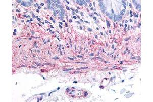 Immunohistochemical (Formalin/PFA-fixed paraffin-embedded sections) staining in human colon (smooth muscle) with TACR2 polyclonal antibody . (TACR2 anticorps)