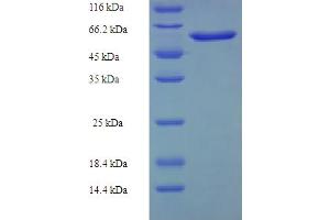 SDS-PAGE (SDS) image for Ribonucleotide Reductase M2 (RRM2) (AA 2-376) protein (His-SUMO Tag) (ABIN5710680) (RRM2 Protein (AA 2-376) (His-SUMO Tag))
