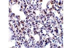 Immunohistochemistry (IHC) image for anti-B-Cell Receptor-Associated Protein 31 (BCAP31) (Middle Region) antibody (ABIN1030882) (BCAP31 anticorps  (Middle Region))